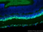 PAX6 Antibody in Immunohistochemistry (Paraffin) (IHC (P))