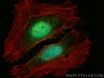 UNG Antibody in Immunocytochemistry (ICC/IF)