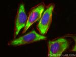 MAGEB1 Antibody in Immunocytochemistry (ICC/IF)