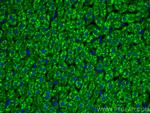 Aconitase 1 Antibody in Immunohistochemistry (PFA fixed) (IHC (PFA))
