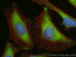 Alix Antibody in Immunocytochemistry (ICC/IF)