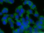 HOMER1 Antibody in Immunocytochemistry (ICC/IF)
