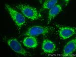 DBT Antibody in Immunocytochemistry (ICC/IF)