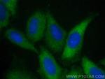 SHC Antibody in Immunocytochemistry (ICC/IF)