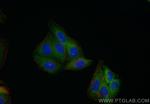 CHMP2B Antibody in Immunocytochemistry (ICC/IF)