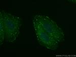 APPL1 Antibody in Immunocytochemistry (ICC/IF)