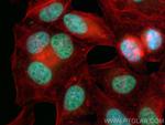 HNRNPD Antibody in Immunocytochemistry (ICC/IF)