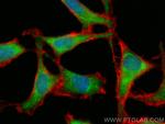 HSPA2 Antibody in Immunocytochemistry (ICC/IF)