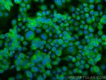 BACE1 Antibody in Immunocytochemistry (ICC/IF)