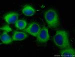 PLS3 Antibody in Immunocytochemistry (ICC/IF)