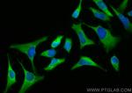 PDE4D Antibody in Immunocytochemistry (ICC/IF)