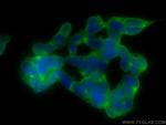 NF-L Antibody in Immunocytochemistry (ICC/IF)