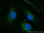 ZFYVE16 Antibody in Immunocytochemistry (ICC/IF)