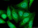 UGDH Antibody in Immunocytochemistry (ICC/IF)