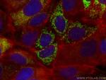 AK3L1 Antibody in Immunocytochemistry (ICC/IF)