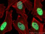 MCM6 Antibody in Immunocytochemistry (ICC/IF)