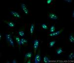 NAT10 Antibody in Immunocytochemistry (ICC/IF)