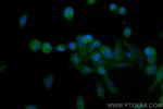MTUS1 Antibody in Immunocytochemistry (ICC/IF)