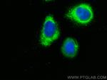 TNNC1 Antibody in Immunocytochemistry (ICC/IF)