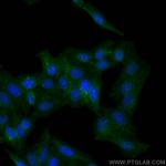 BST2 Antibody in Immunocytochemistry (ICC/IF)