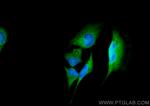 PRDX6 Antibody in Immunocytochemistry (ICC/IF)