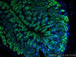 TFF2 Antibody in Immunohistochemistry (PFA fixed) (IHC (PFA))