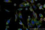 NEDD4L Antibody in Immunocytochemistry (ICC/IF)