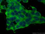 CaMKII alpha Antibody in Immunocytochemistry (ICC/IF)