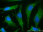 TRAK2 Antibody in Immunocytochemistry (ICC/IF)