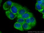 AEG-1/MTDH Antibody in Immunocytochemistry (ICC/IF)