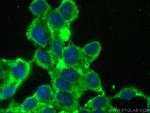 Synaptojanin 2 Antibody in Immunocytochemistry (ICC/IF)