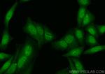 CHEK2 Antibody in Immunocytochemistry (ICC/IF)