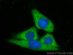 FATP2 Antibody in Immunocytochemistry (ICC/IF)