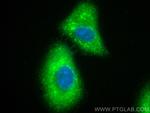 PDGF-D Antibody in Immunocytochemistry (ICC/IF)