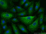 Talin-1 Antibody in Immunocytochemistry (ICC/IF)