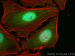 TRIM24 Antibody in Immunocytochemistry (ICC/IF)