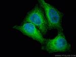 NFKB1, p105, p50 Antibody in Immunocytochemistry (ICC/IF)