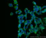 MMP19 Antibody in Immunocytochemistry (ICC/IF)
