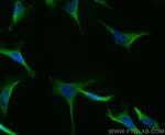 DIAPH3 Antibody in Immunocytochemistry (ICC/IF)
