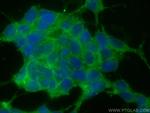 Alpha N-Catenin Antibody in Immunocytochemistry (ICC/IF)