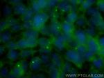 PIBF1 Antibody in Immunocytochemistry (ICC/IF)