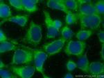 MSRA Antibody in Immunocytochemistry (ICC/IF)