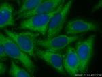 MMP14/MT1-MMP Antibody in Immunocytochemistry (ICC/IF)