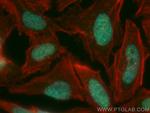TERF2IP Antibody in Immunocytochemistry (ICC/IF)