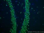 BRN2 Antibody in Immunohistochemistry (PFA fixed) (IHC (PFA))