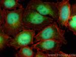 MAGEA6 Antibody in Immunocytochemistry (ICC/IF)