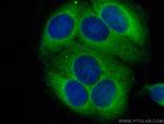 RABEP2 Antibody in Immunocytochemistry (ICC/IF)