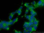 PPP1R15B Antibody in Immunocytochemistry (ICC/IF)