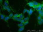 ASNS Antibody in Immunocytochemistry (ICC/IF)