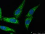 CRMP2 Antibody in Immunocytochemistry (ICC/IF)